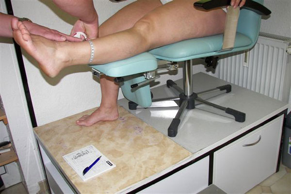 Kompressionsstrumpftherapie Kompressionsstrumpftherapie